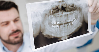 Rare Lesions of the Jaw Directory